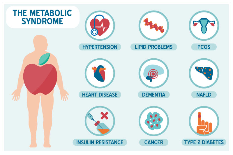 High cholesterol, obesity, heart disease, diabetes, and liver disease are all metabolic syndrome conditions.